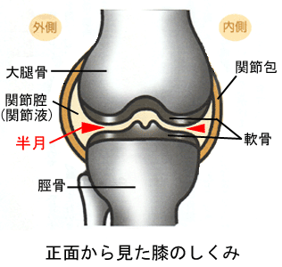 名古屋市の整体・半月板損傷・半月板断裂