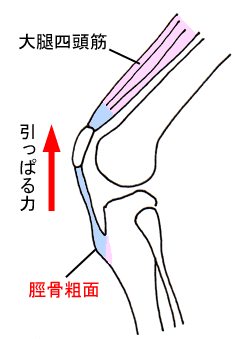 名古屋の整体・成長痛・膝の痛み・オスグット・半月板損傷・ジャンパー膝・オスグット病